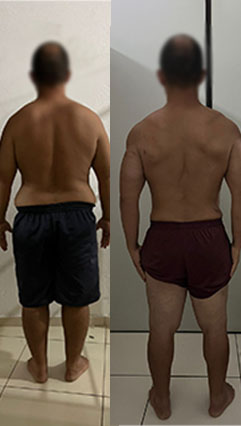ANTES-E-DEPOIS-01
