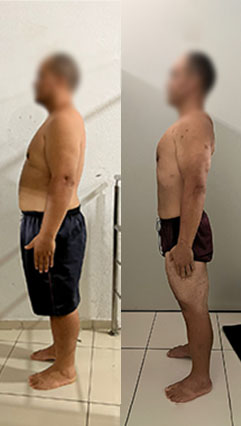 ANTES-E-DEPOIS-02