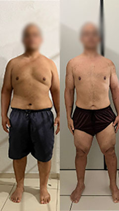 ANTES-E-DEPOIS-03