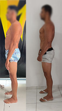 ANTES E DEPOIS 06