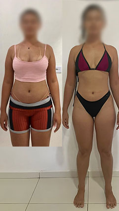ANTES E DEPOIS 07