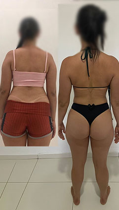 ANTES E DEPOIS 08