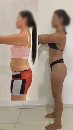 ANTES E DEPOIS 09